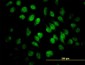 SAFB1 / SAFB Antibody (clone 5A11)